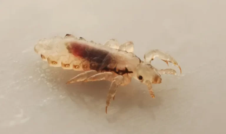 Can Black People Get Lice