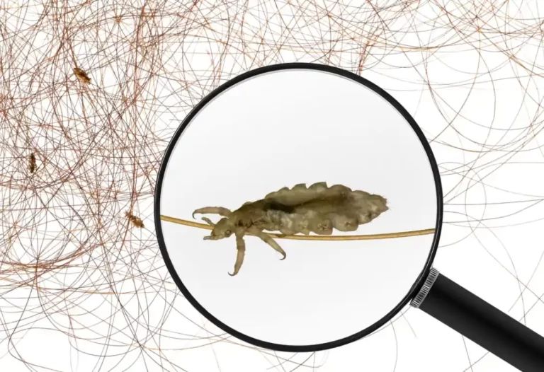Head lice (louse) - view through a magnifying glass and human hair with head lice (louse).