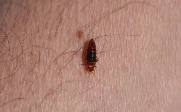 Adult bed bug on skin after feeding for 14 minutes and fully engorged