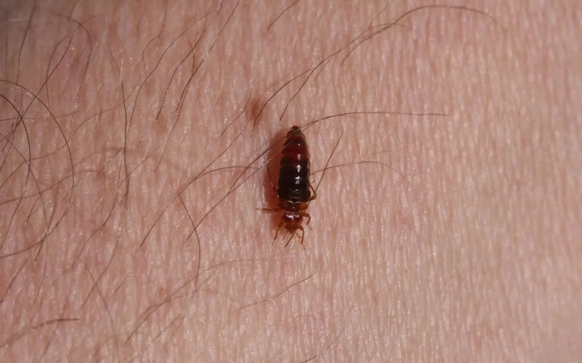 Bed Bug Exterminators Near Me: Cost & Reviews 1 Adult bed bug on skin after feeding for 14 minutes and fully engorged