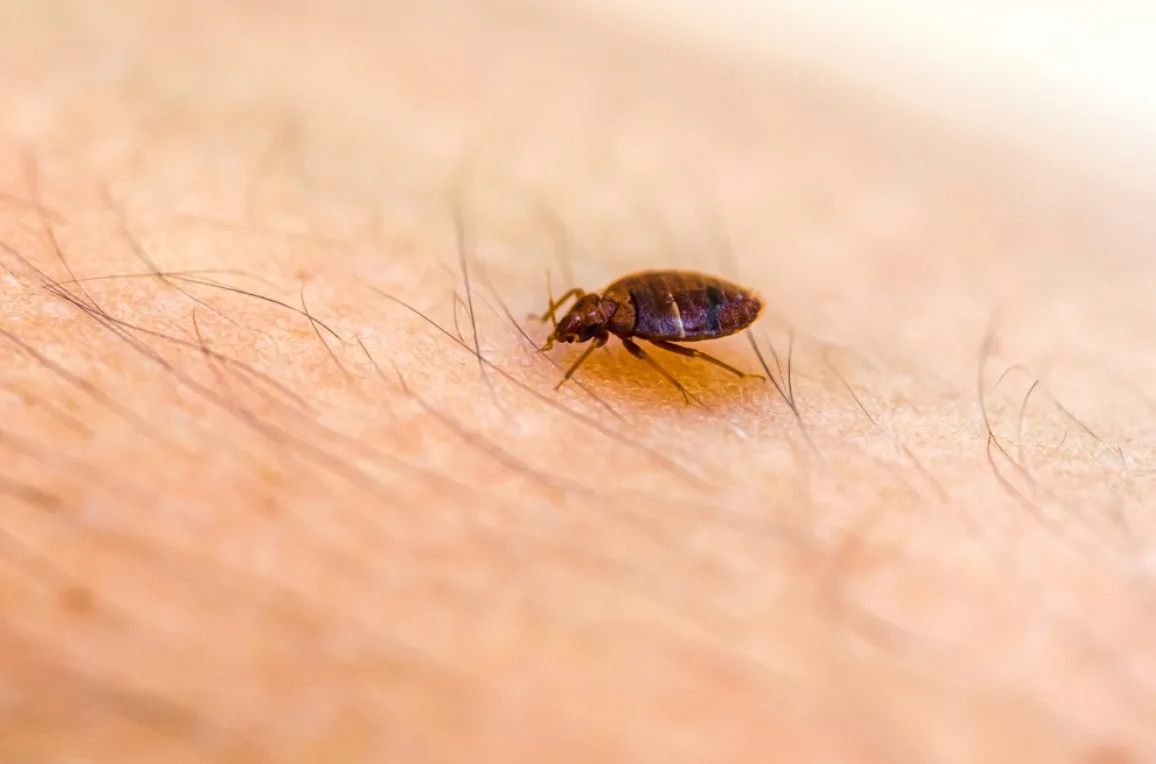 Bed Bug Up Close On Skin Bed Bug Up Close On Skin