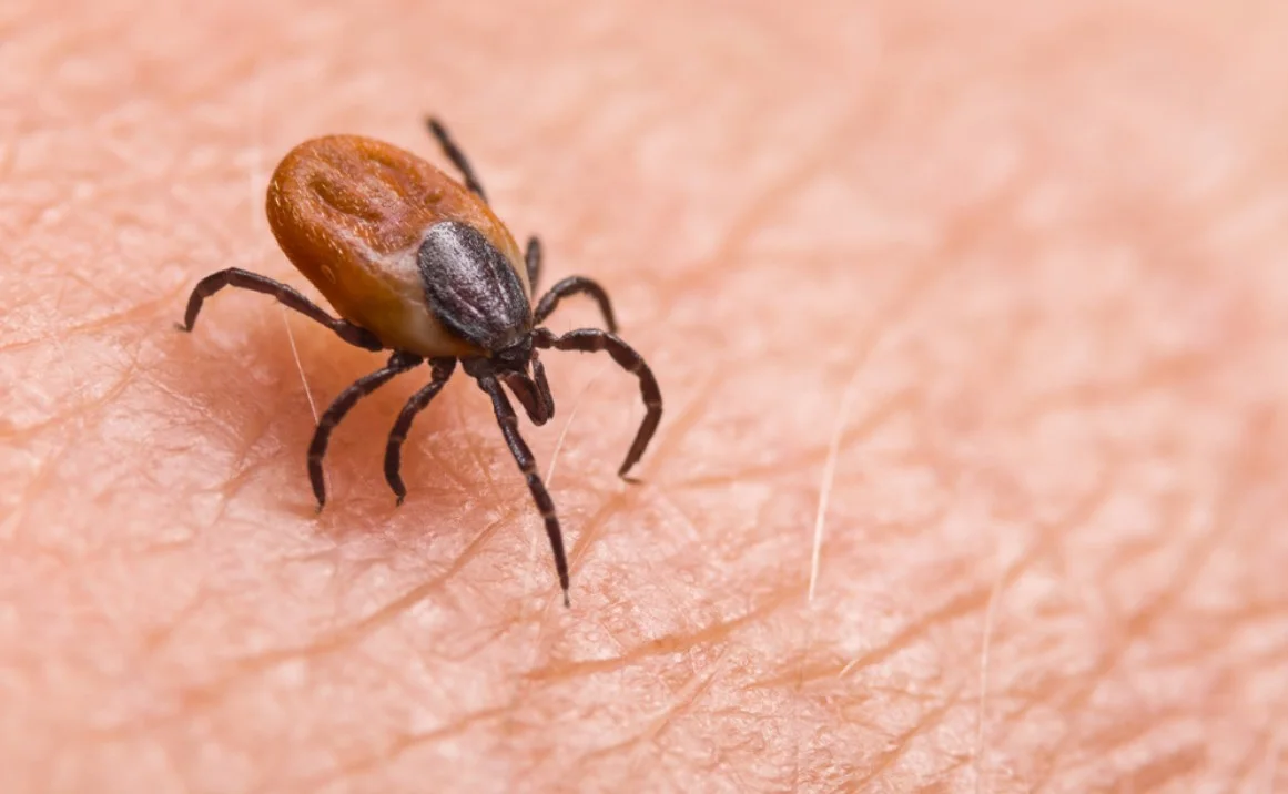 Does Permethrin Kill Ticks on Contact (Dogs & Horses)? 1 Infizierte weibliche Hirschzecke auf behaarter menschlicher Haut. Ixodes ricinus