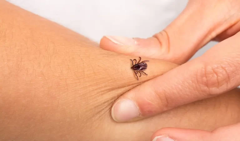 Tick that is biting an arm to a girl