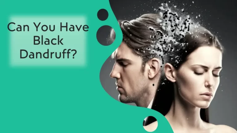 Can You Have Black Dandruff