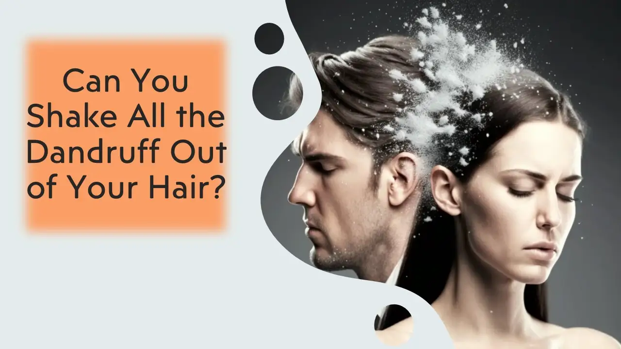 Can You Shake All the Dandruff Out of Your Hair? 1 Can You Shake All the Dandruff Out of Your Hair