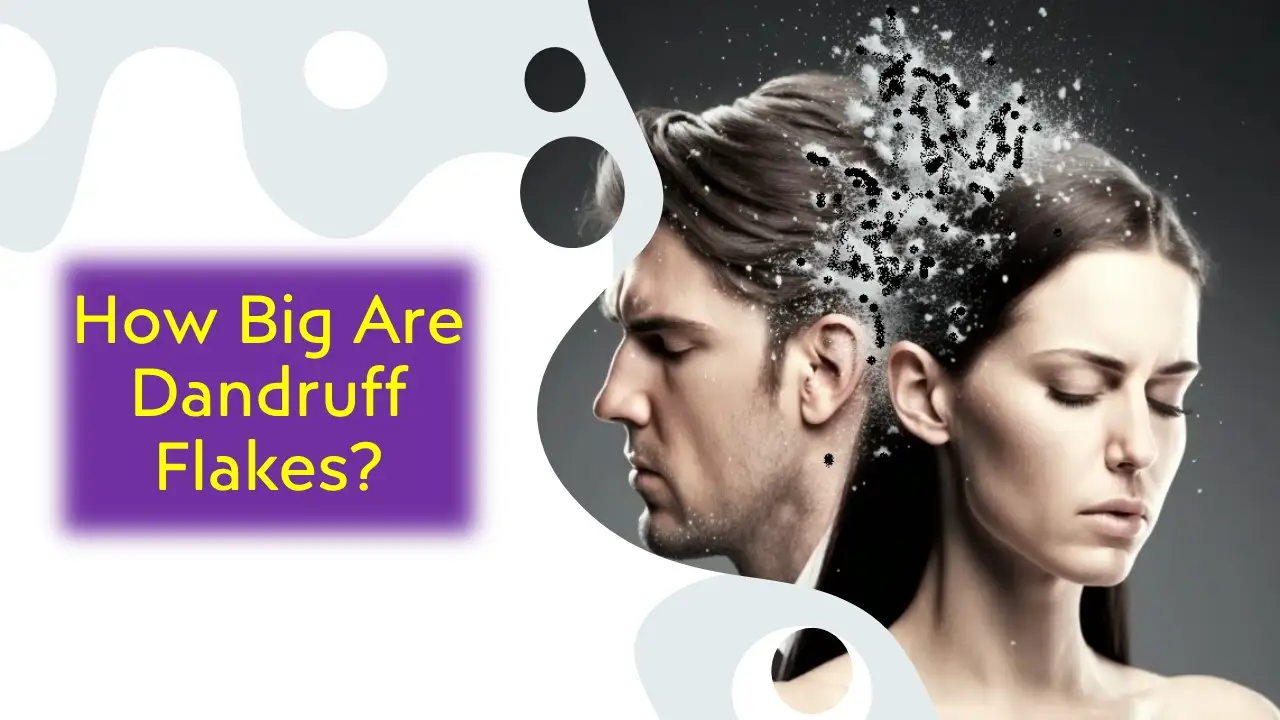 How Big Are Dandruff Flakes? 1 How Big Are Dandruff Flakes