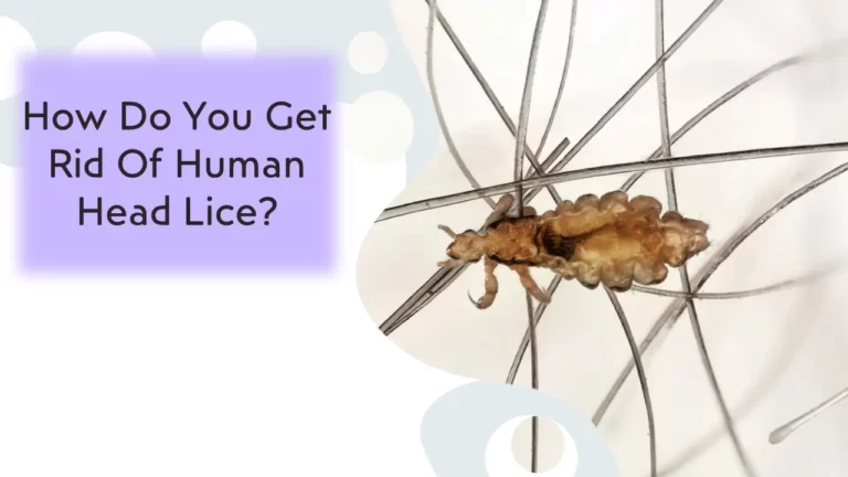 How Do You Get Rid Of Human Head Lice